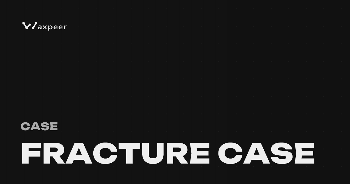 Computer Case Fracture Fracture Case Skins – CS2 | WAXPEER